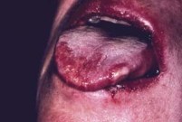 TESHIS KOYMAK ICIN TIKLAYIN